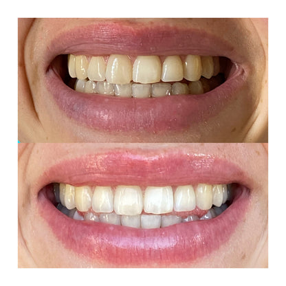 Duo dentifrice jour & nuit